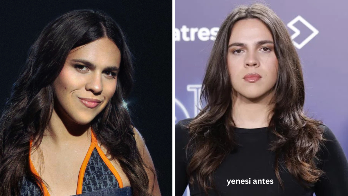Yenesi Antes Yenesi Antes